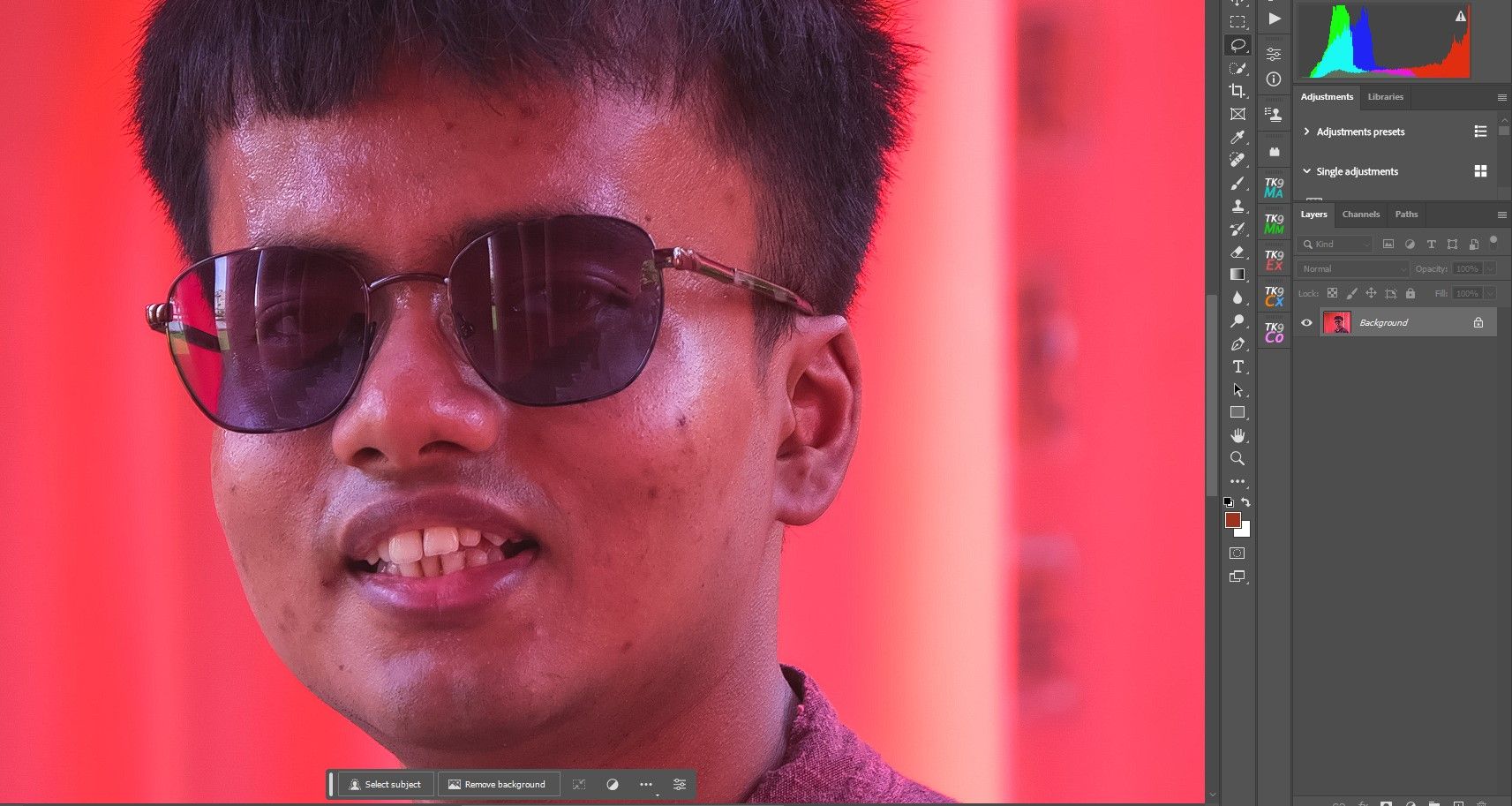 /sv/images/screenshot-example-of-a-person-with-blemishes.jpg